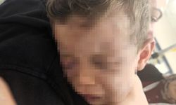 Tedavisinin ardından devlet korumasına alınan bebek 1 hafta sonra ameliyat edilecek