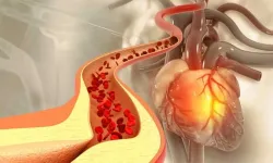 Sessiz tehlike: Kötü kolesterol 20’li yaşlarda ortaya çıkabiliyor