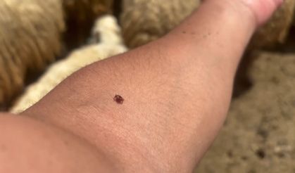 Kene tutundukça, hastalık riski artıyor: Bulaş riski çok düşük