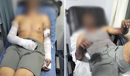 Manisa'da sanayi sitesinde patlama... Yaralılar var!