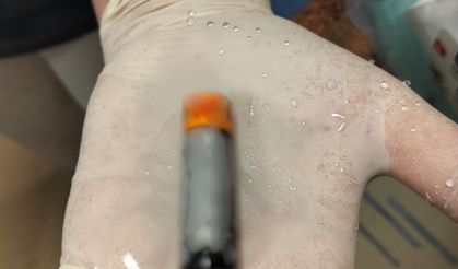 Yuttuğu pil midesinden çıkartılan orta yaş grubu hasta sağlığına kavuştu