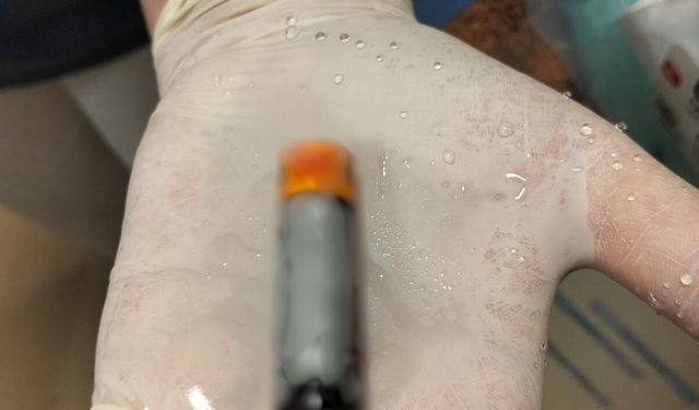 Yuttuğu pil midesinden çıkartılan orta yaş grubu hasta sağlığına kavuştu