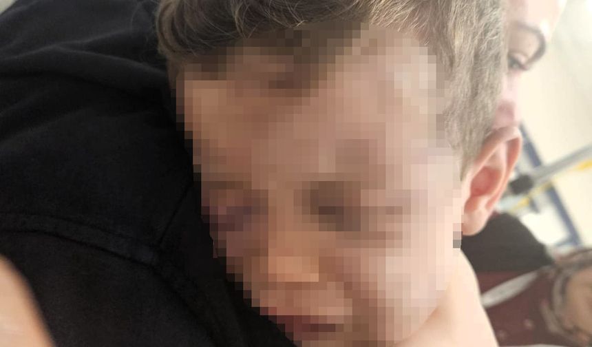 Tedavisinin ardından devlet korumasına alınan bebek 1 hafta sonra ameliyat edilecek
